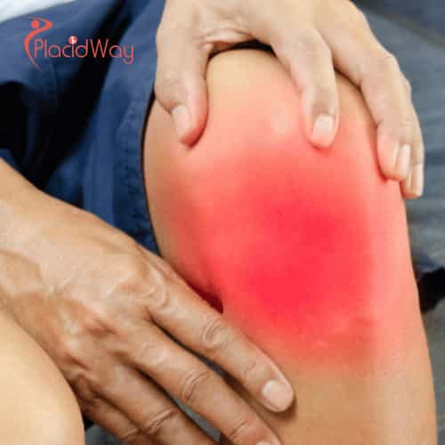 Affordable Stem Cell Therapy for Knee Pain in Germany for UK Patients from London